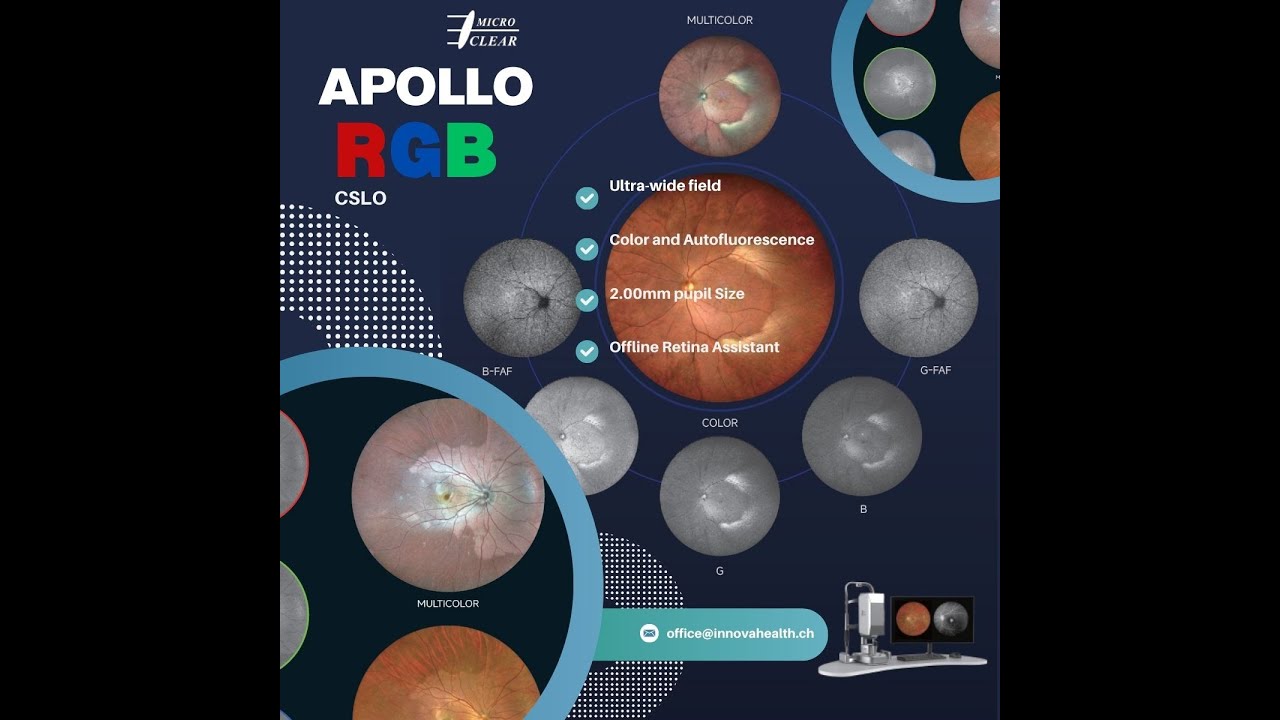 Apollo by Microclear – Ultra-Widefield Retinal Imaging Like Never Before