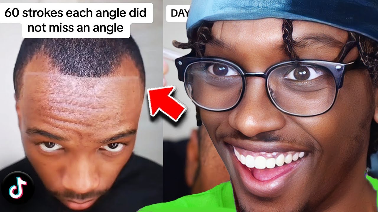 I Met The Only Man That Can Save My Hairline..