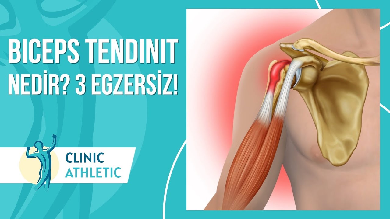 Biceps Tendinit Neden Oluşur? | 3 Harika Egzersiz!