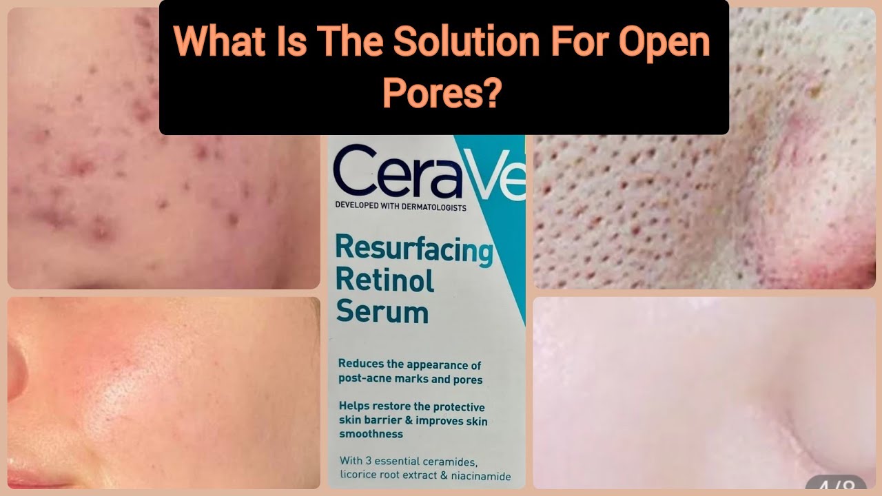 Уменьшите следы постакне и поры с помощью сыворотки Cerave Resurfacing Retinol