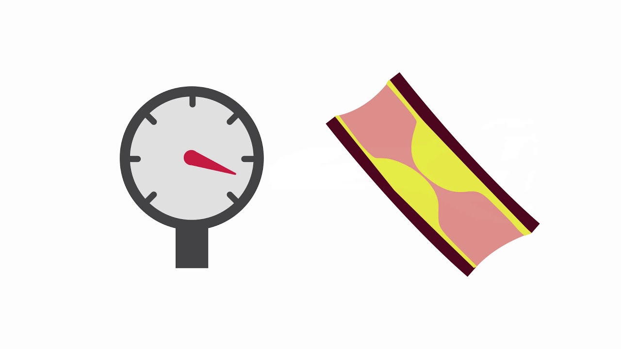Identifying common hemodialysis access complications