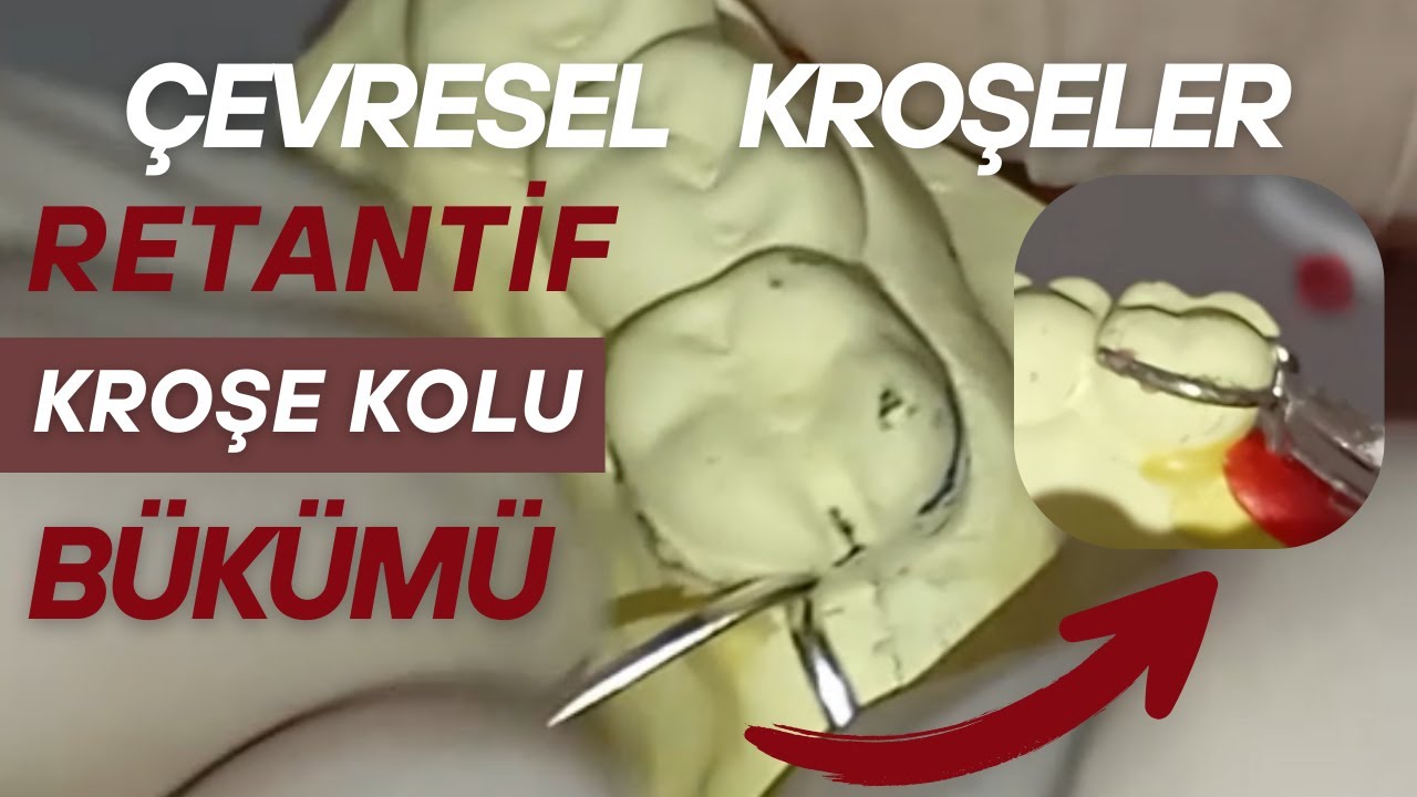 Çevresel Kroşe Bükümü- Resiprokal Kroşe Kolu