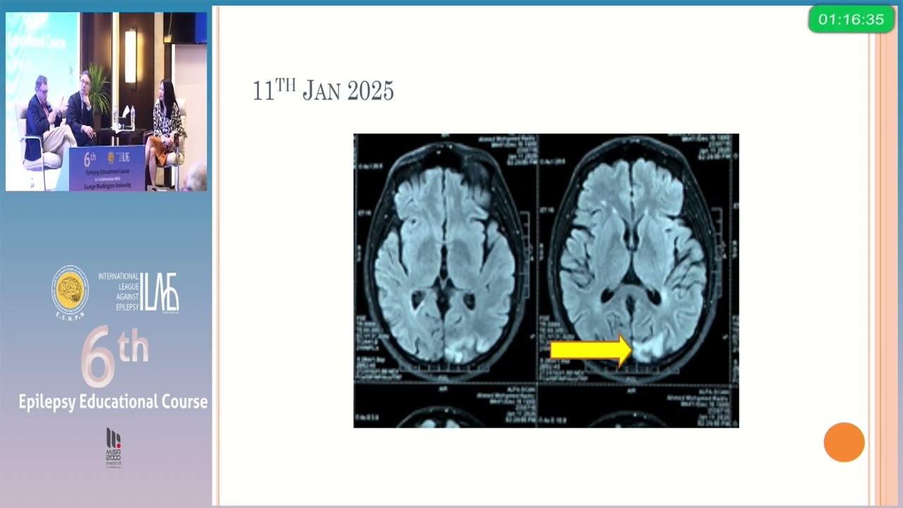6th Epilepsy educational course Day1 P9