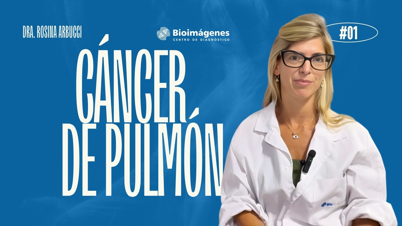 🫁 Cáncer de pulmón: causas, síntomas y por qué la detección temprana puede salvar vidas