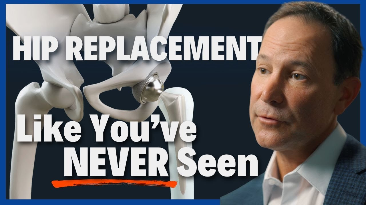 Total Hip Replacement: One Step Can Change Your Life FOREVER