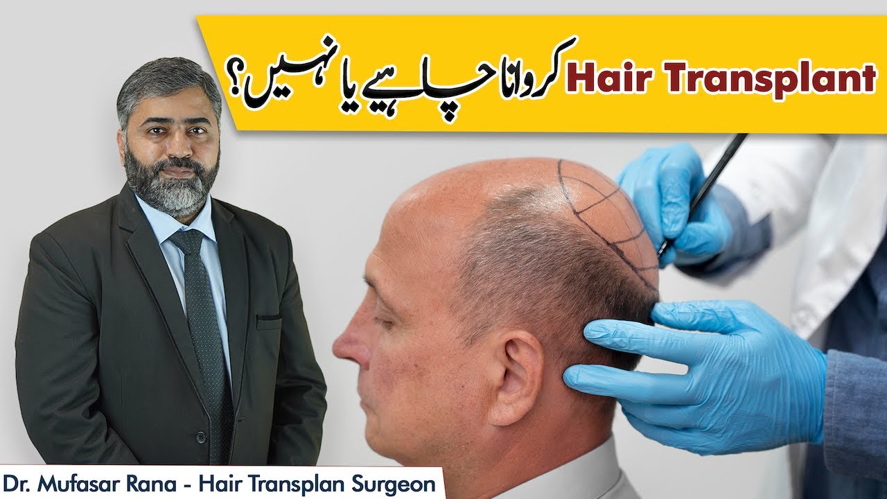 Hair Transplant Price In Pakistan | Hair Transplant Kaise Hota Hai | Is Hair Transplant Painful?