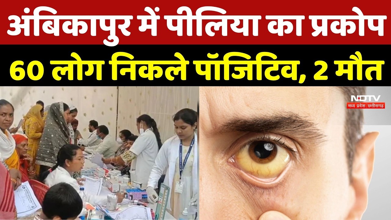 Chhattisgarh Jaundice Outbreak: Ambikapur में Jaundice का प्रकोप, 60 लोग निकले पॉजिटिव, 2 मौत | cg