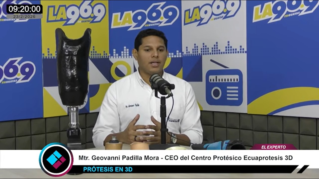 PRÓTESIS EN 3D Y AVANCES TECNOLÓGICOS | Por LA 96.9 FM⚡