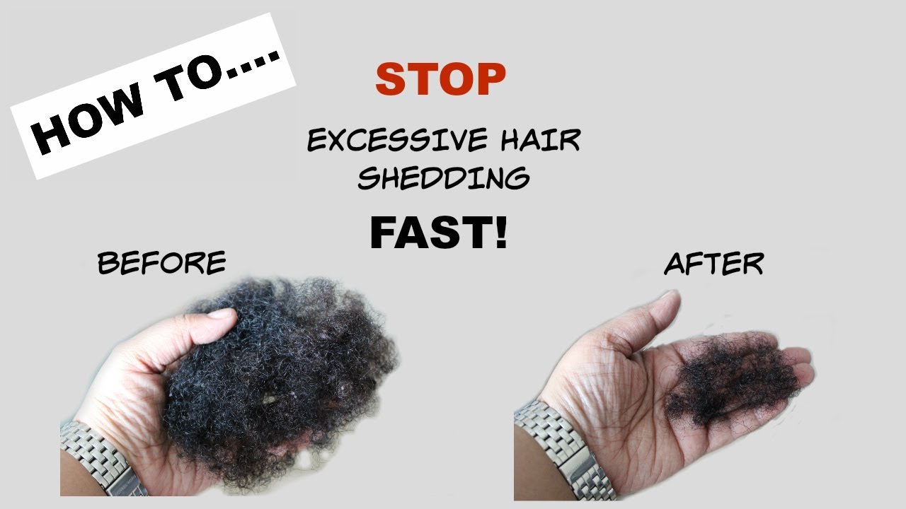 STOP Excessive Hair Shedding Fast | Tea Rinse | Natural Hair