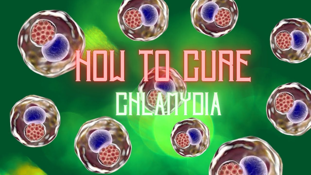 How to Cure - Chlamydia