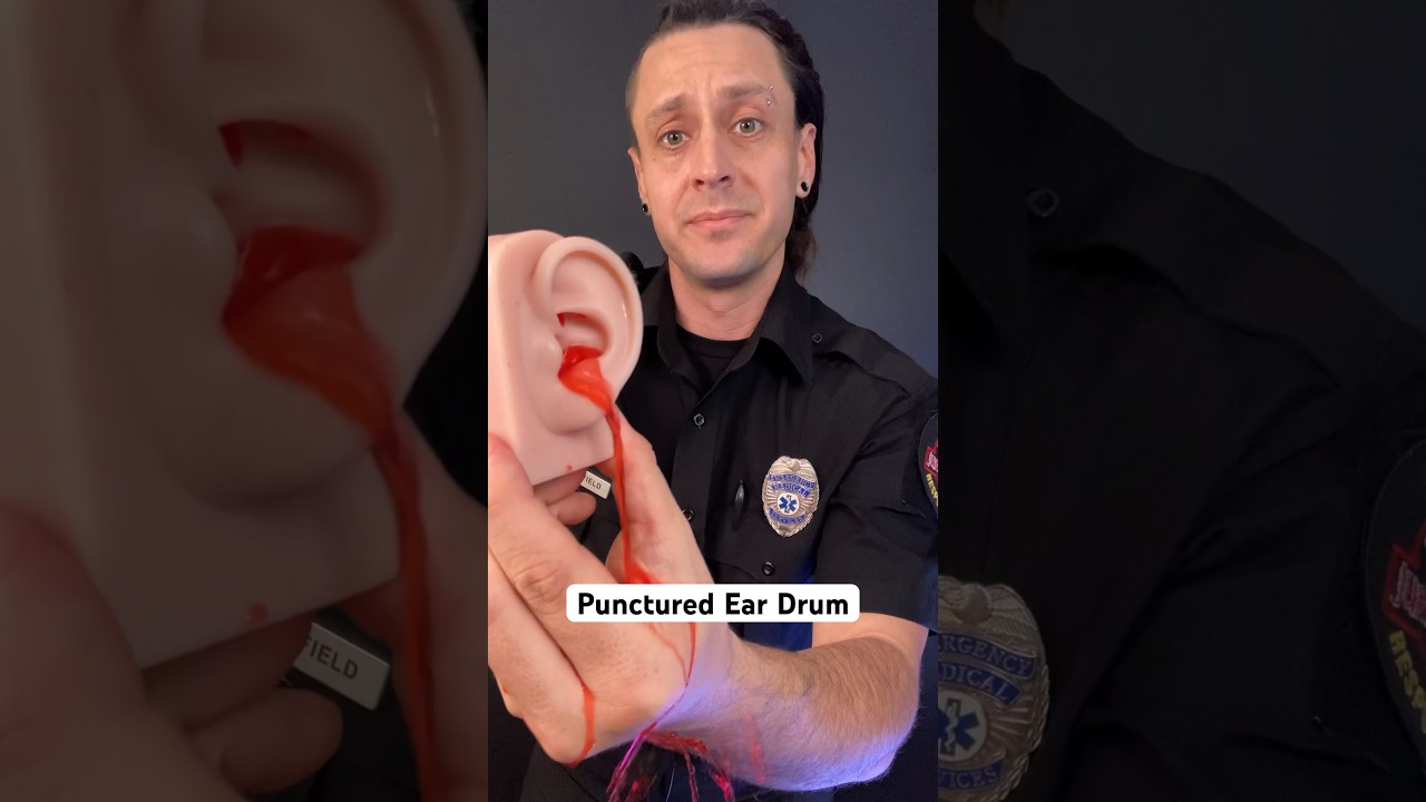 Punctured ear drum? Try this&hellip; #survival #medical #health