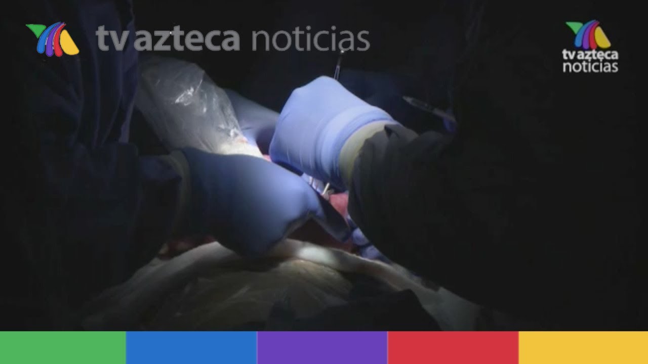 ¿Cómo registrarse para ser donador de órganos en México?