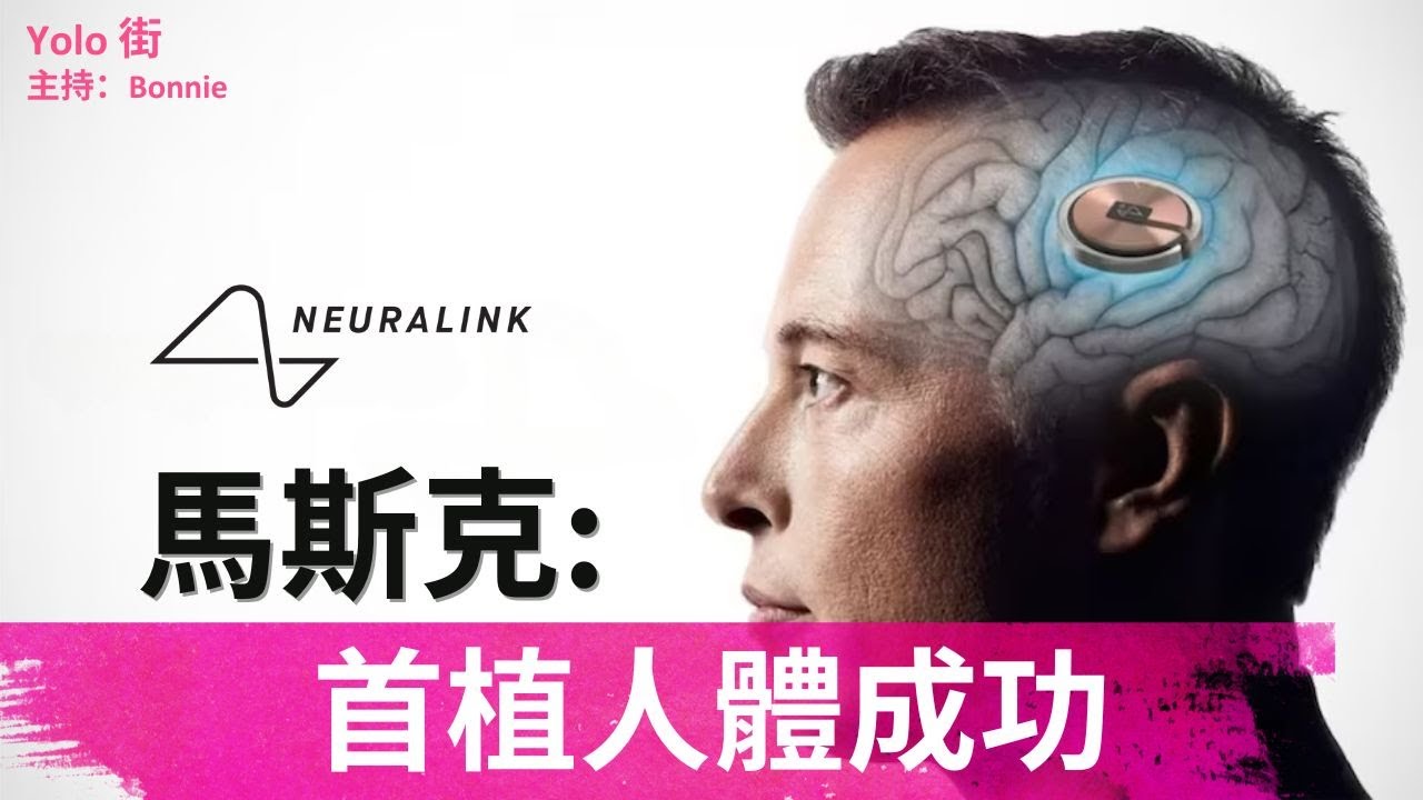 科幻變現實：馬斯克Neuralink人腦腦機介面植入首實現 真的邁向人類與AI融合?