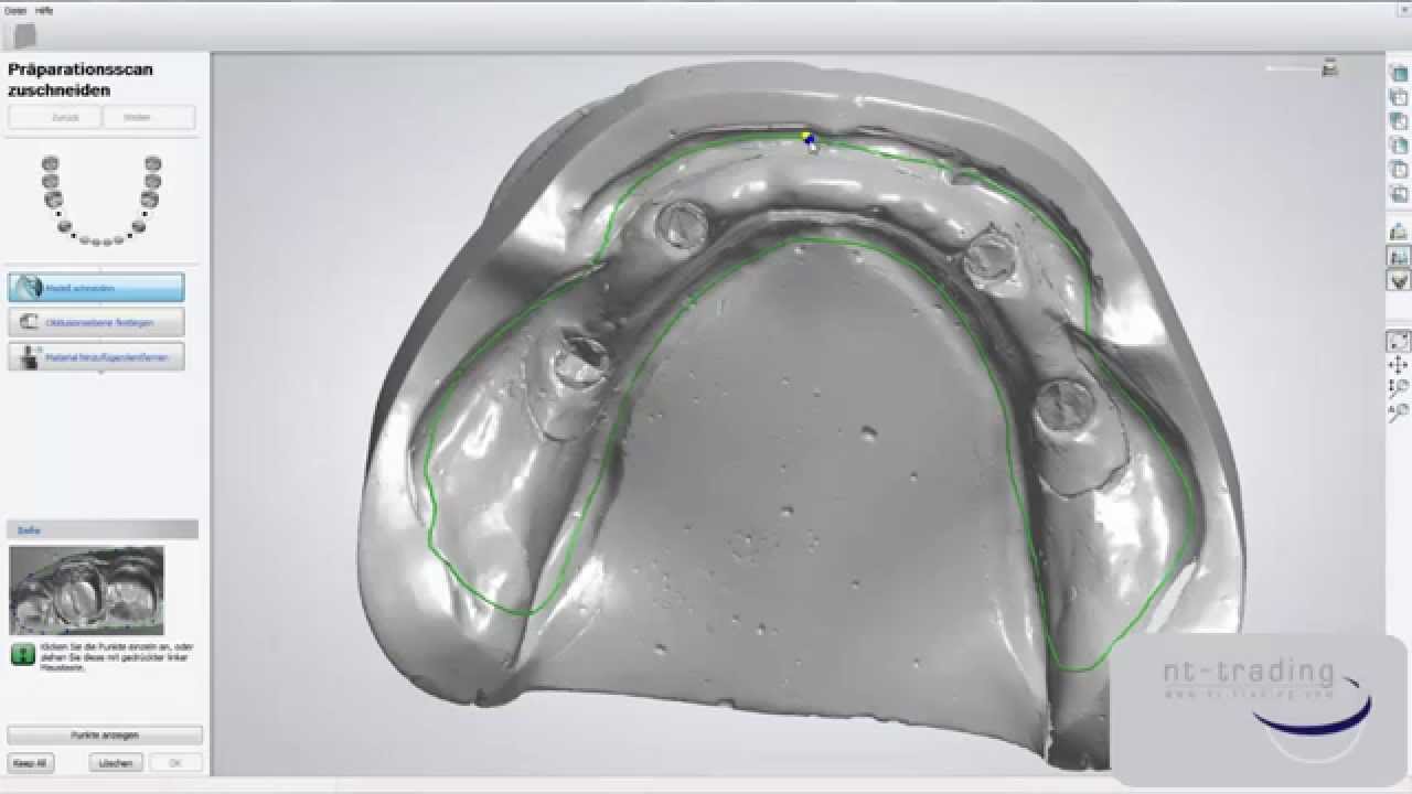 NT Dental - DIM Modell Design in 3shape®