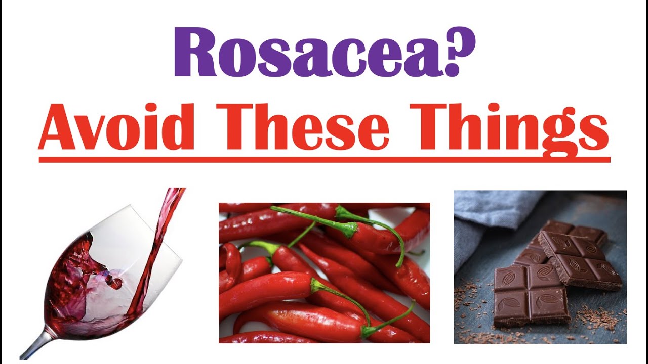What To Avoid If You Have Rosacea | Most Common Triggers of Symptoms (Diet, Environmental)