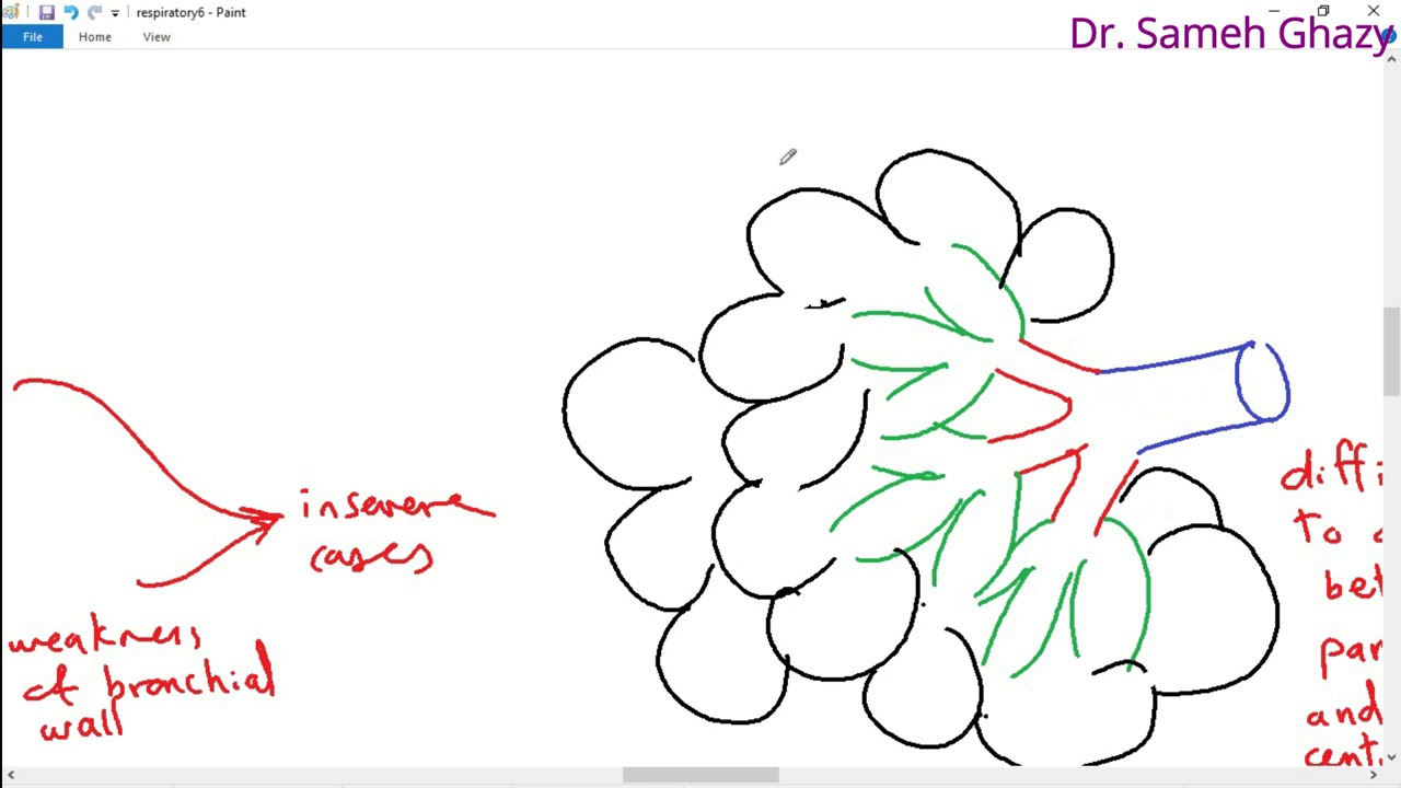 Systemic pathology 17 : respiratory system 3 ( emphysema ) DR.SAMEH GHAZY