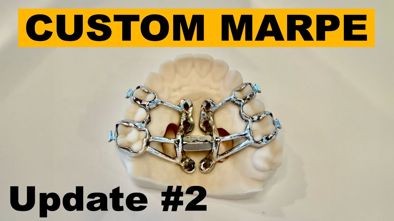 MARPE Update #2
