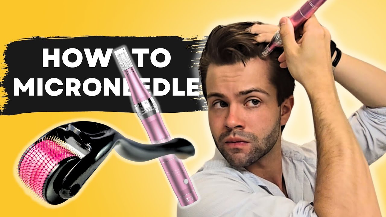 Derma Roller vs. Derma Pen: Which is Best for Hair Loss?