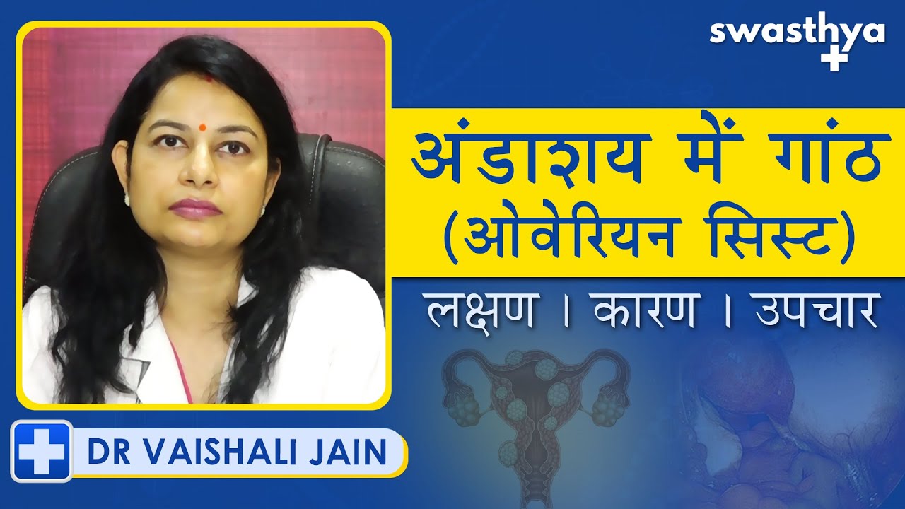 अंडाशय में गांठ (ओवेरियन सिस्ट) - कारण, लक्षण, उपाय | Dr Vaishali Jain on Ovarian Cyst in Hindi
