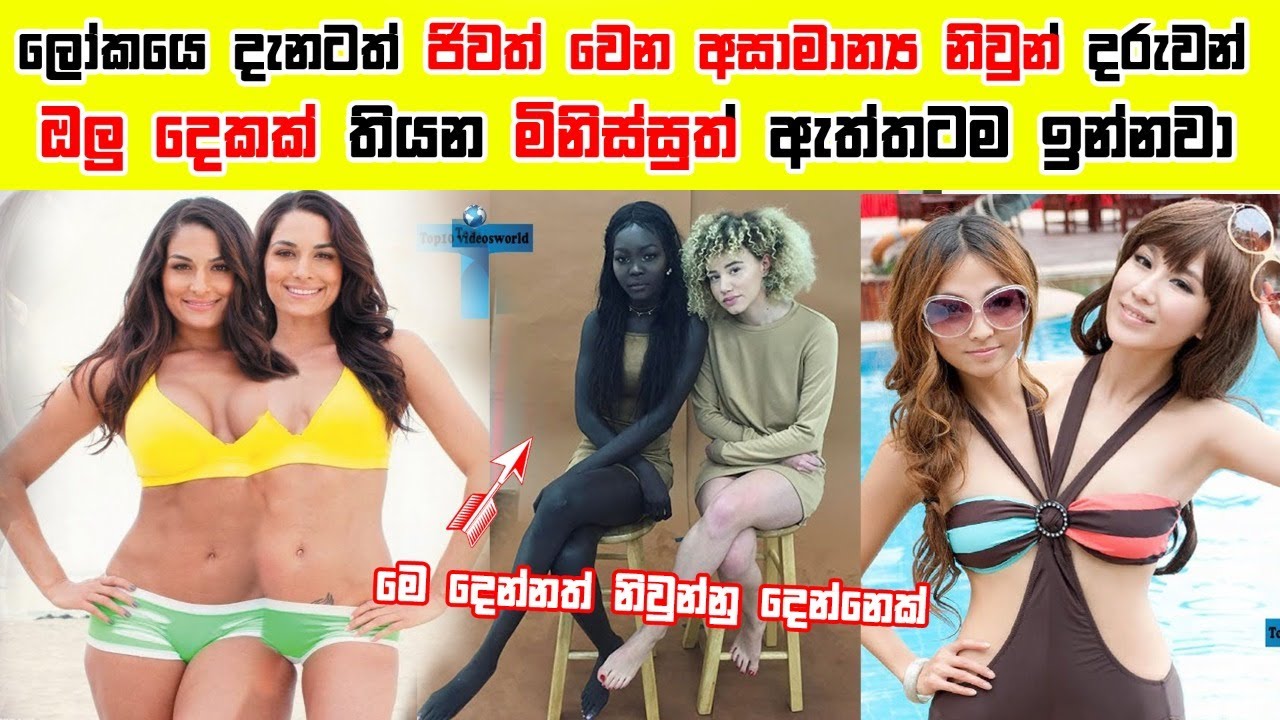 ලෝකයේ දැනටමත් ජීවත්වන ජීවත් වන අසාමාන්‍ය නිවුන් දරුවන්/Unusual twins/thorathuru