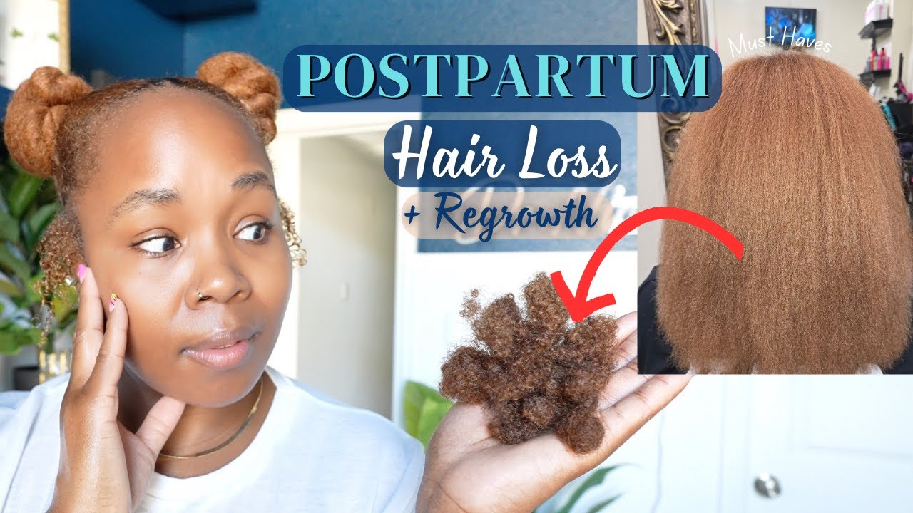 My Postpartum Hair Loss, Shedding & Regrowth | Real Tips & Essential Products!