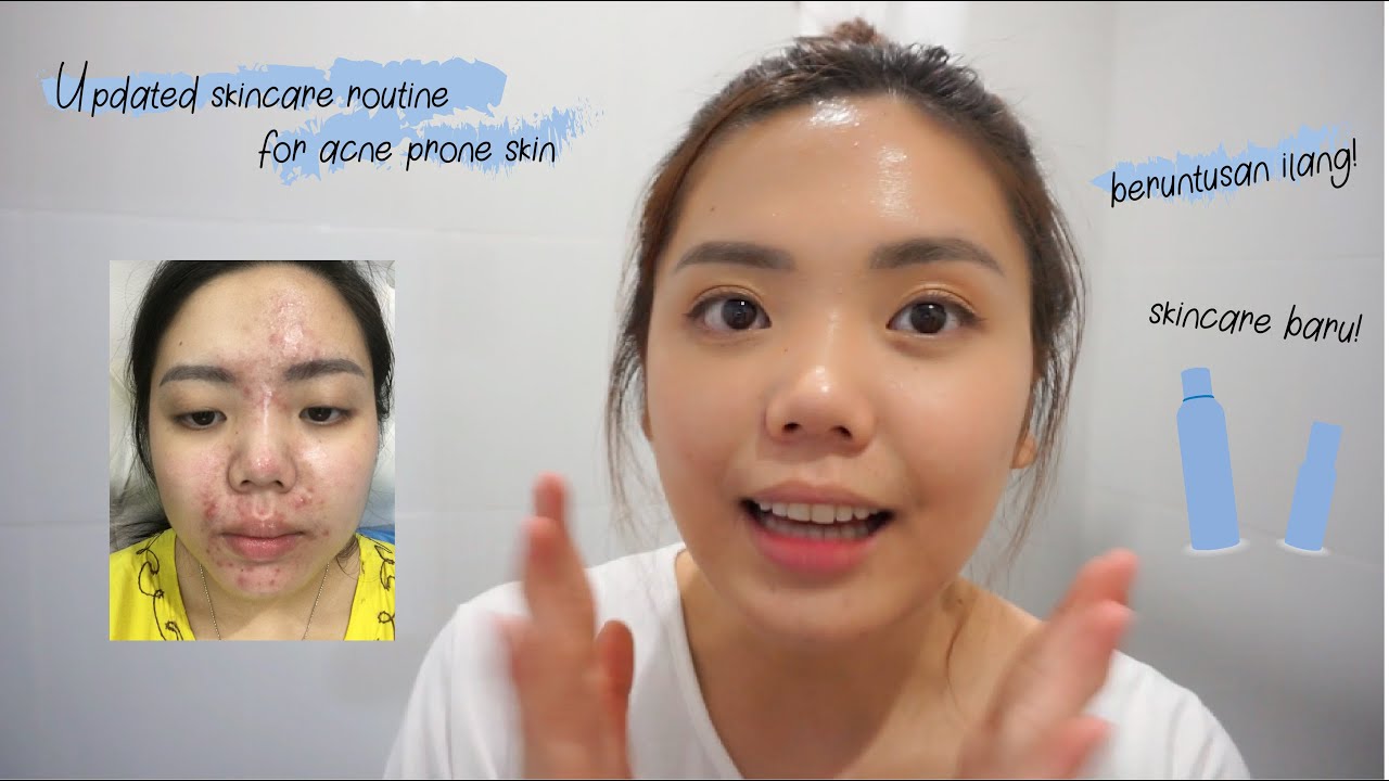 MY UPDATED SKINCARE ROUTINE | SKINCARE UNTUK KULIT JERAWAT