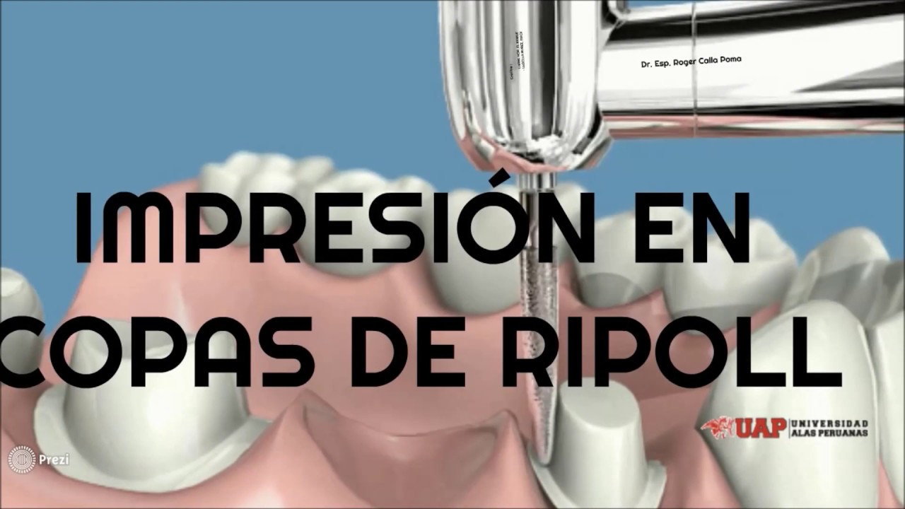 DR. ESP. ROGER CALLA -  Impresion con Copas de Ripoll