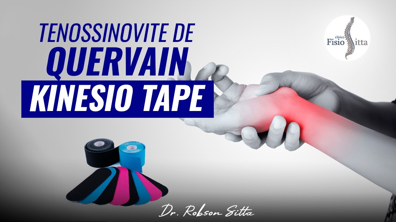 BANDAGEM PARA TENOSSINOVITE DE QUERVAIN KINESIO TAPE - FISIOTERAPIA Clínica Dr. Robson Sitta ®
