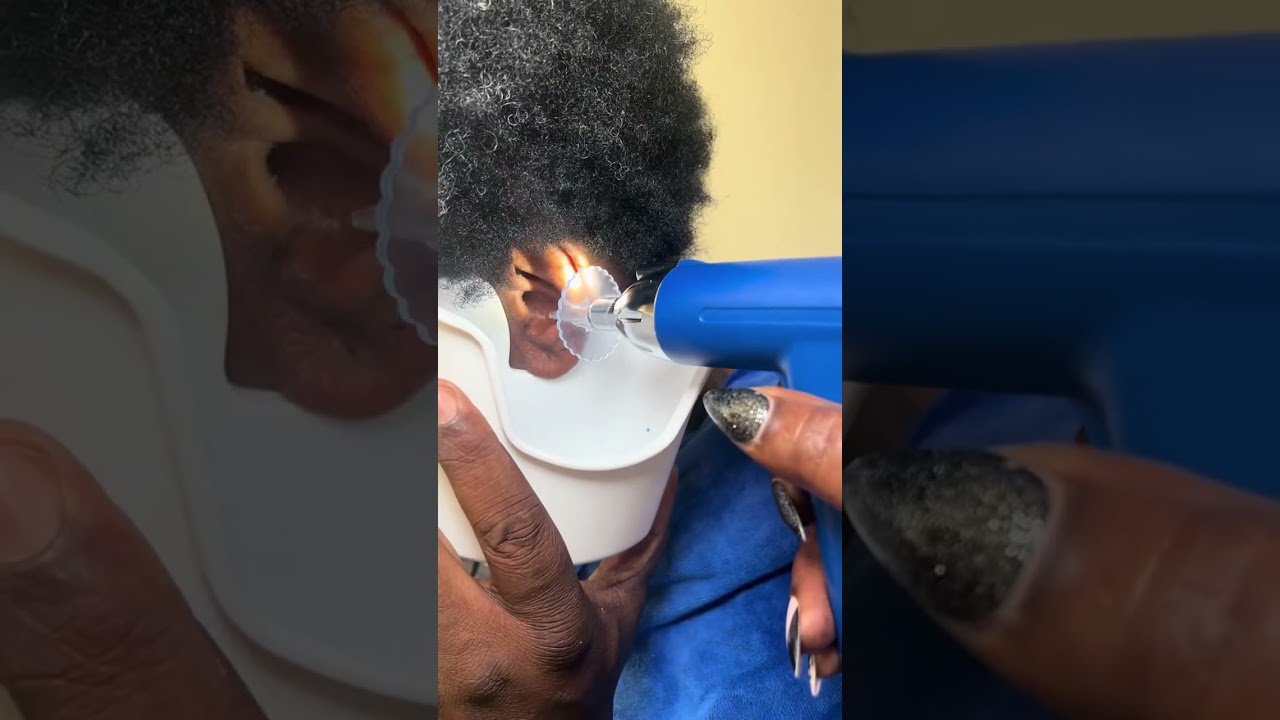 Safely Flush Earwax! Top-Rated Review! 