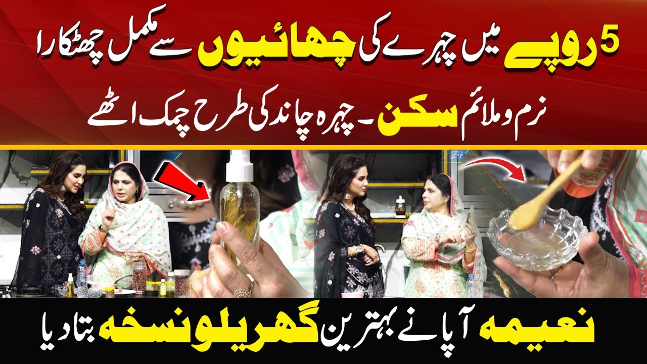 Easy Way To Remove Freckles In Just 5 Rupees | Best Home Remedies | City41