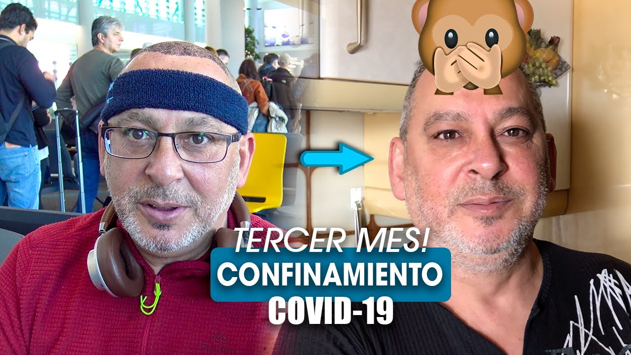 INJERTO CAPILAR DURANTE CONFINAMIENTO - COVID 19, TERCER MES