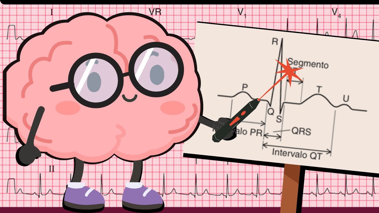 ¿Podrías reconocer los componentes del ECG sin verlos? (Ondas, intervalos y derivadas cardiacas)?