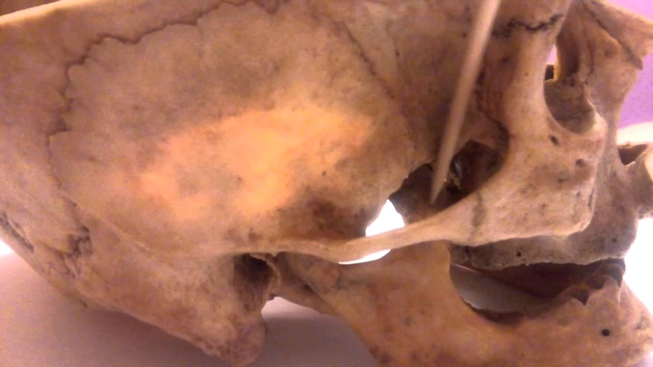 Fosa temporal e infratemporal