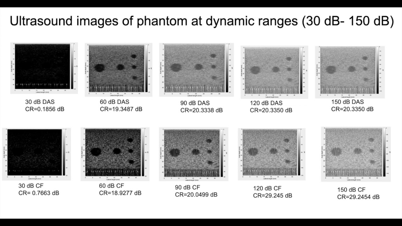 Beamforming in ultrasounding imaging