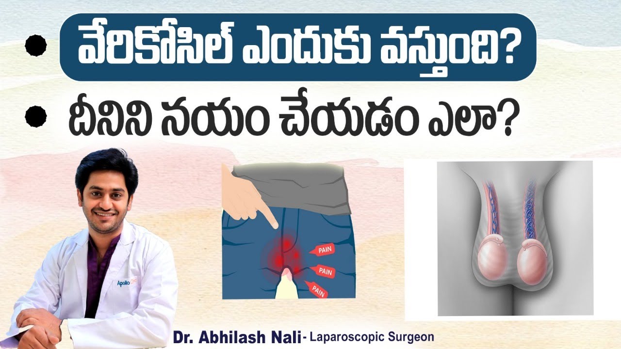 వేరికోసిల్ లక్షణాలు - చికిత్స || Symptoms and Treatment of Varicocele in Telugu || Dr Abhilash Nali