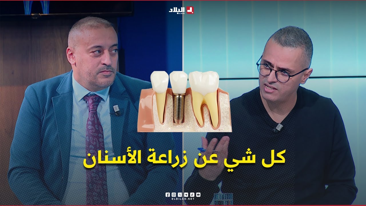 دكتور+| مراحل عملية زراعة الأسنان