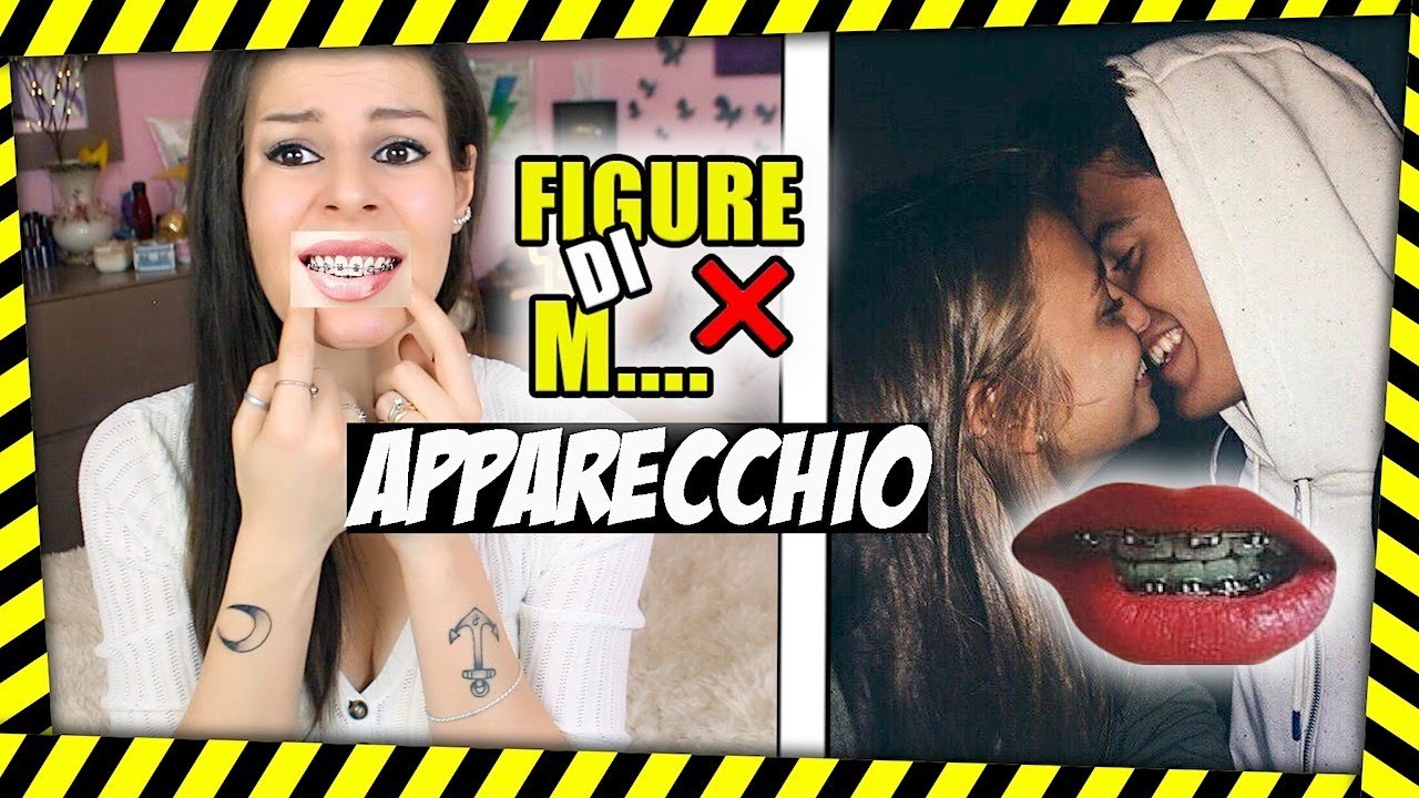 FIGURE DI M.... CON L'APPARECCHIO ❌ insegreto #94