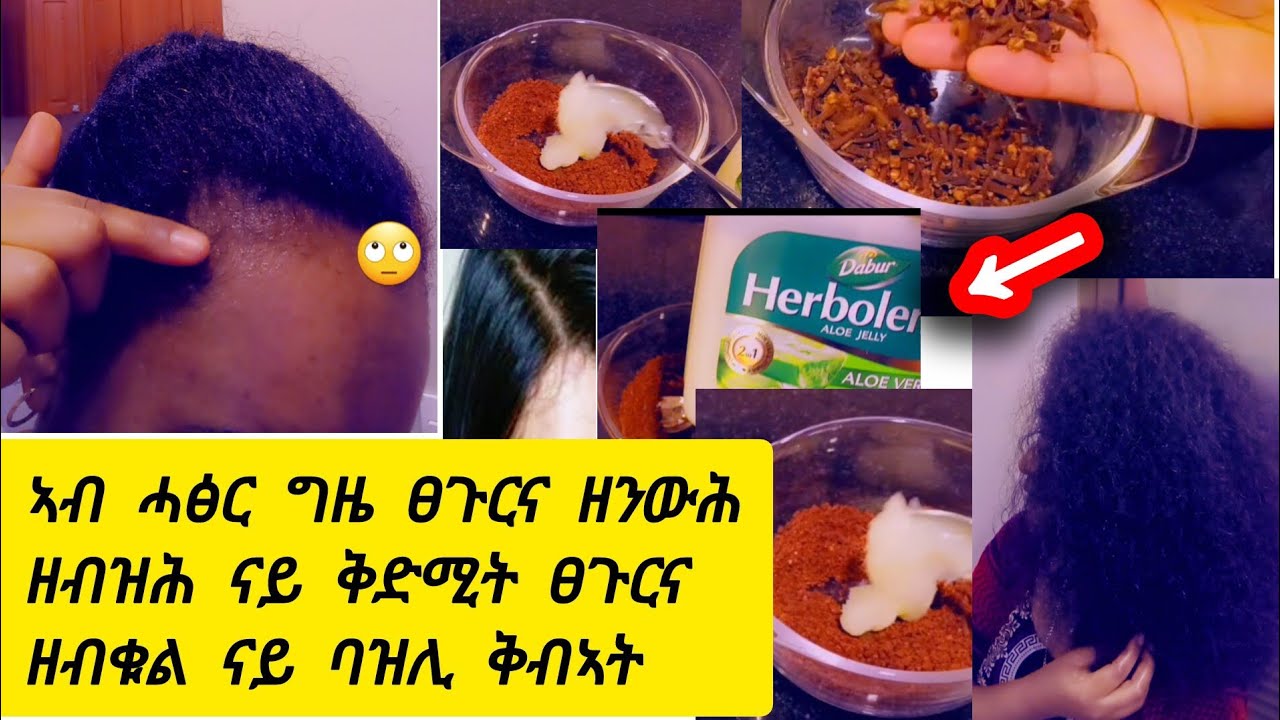 🛑ኣብ ሓፅር #ግዜ ፀጉርና ዘንውሕ #ዘብዝሕ ናይ ቅድሚት #ዘብቁል ናይ ባዝሊ ቅብኣት #lovely  #habesha  #duet  #music 