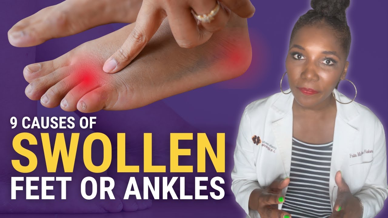 Foot and Ankle Swelling: 9 Dangerous Causes You Should NEVER Ignore!