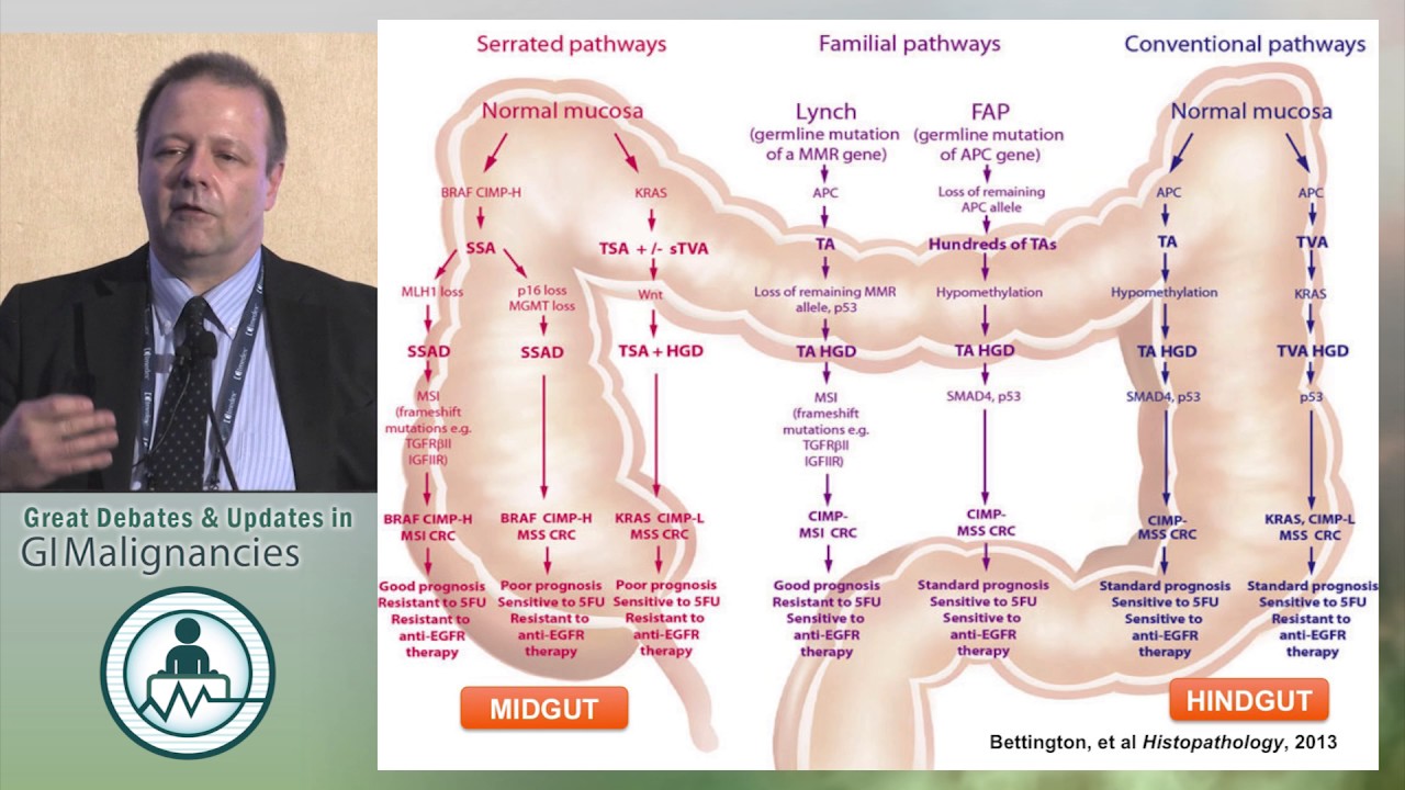 Debate: Targeted therapy for RAS/BRAF WT left sided colon cancers - Bevacizumab or EGFR antibodies