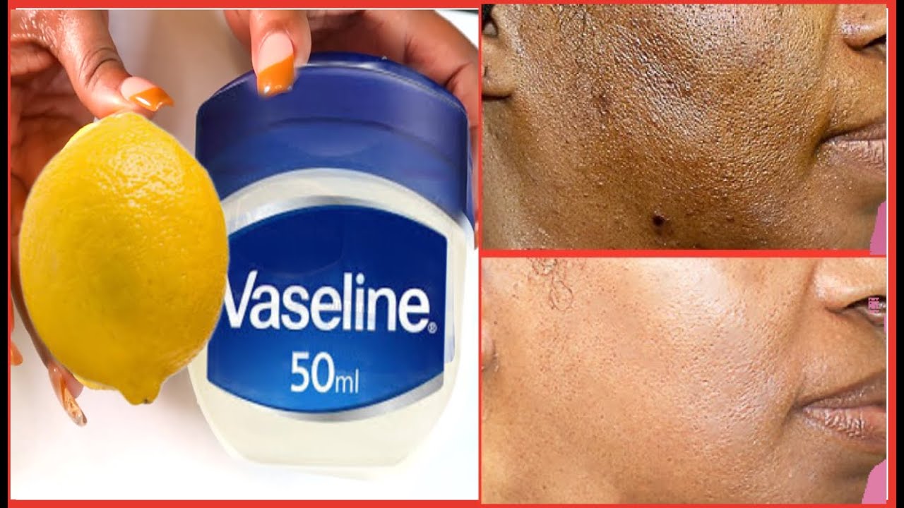 The Best Way To Use Vaseline And Lemon On Skin For Clearing Dark Spots, Wrinkles & Get Glowing Skin
