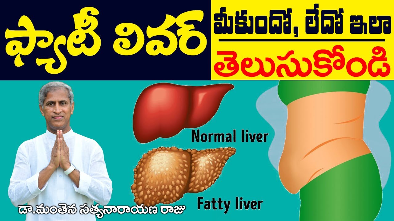 Fatty Liver | ఫ్యాటీ లివర్ : మీకుందో లేదో ఇలా తెలుసుకోండి ! | Dr Manthena Satyanarayana Raju Videos
