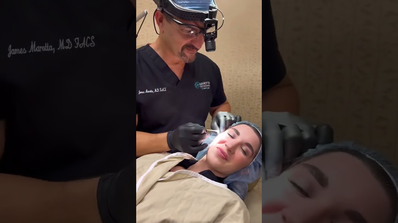 TCA Spot Peel with Dr. Marotta #facialplasticsurgeon #cosmeticsurgeon #tcapeel