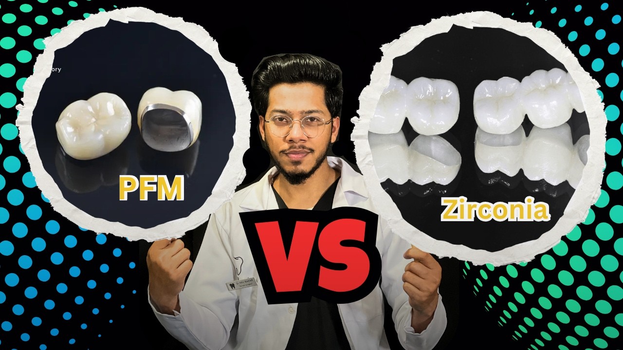 PFM vs Zirconia Crowns: Which fix teeth Better in 2026? Full Detailed Comparison