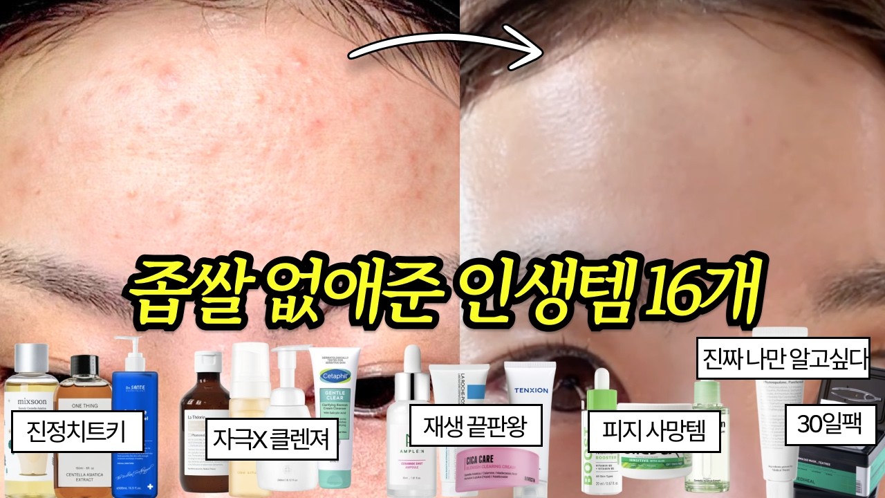 좁쌀 없애준 인생템 16가지! 와.. 이렇게 쉬운거였어? (광고X)