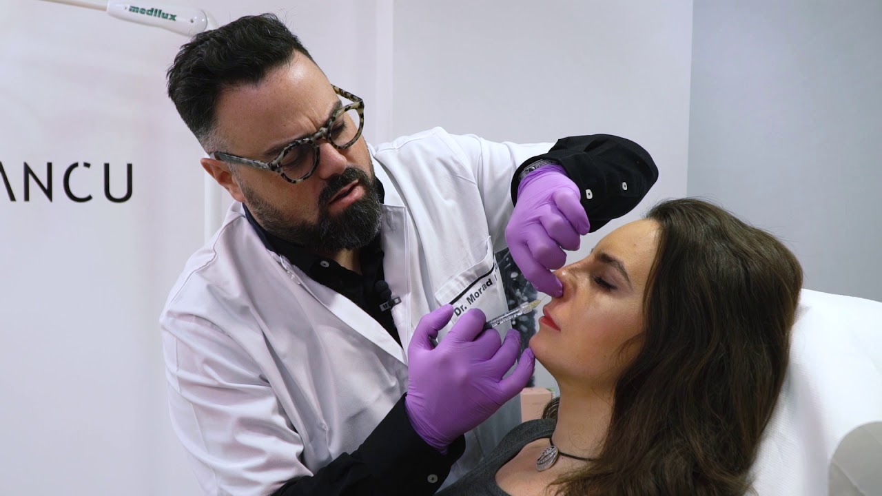 Dr. Iancu Morad- Procedura de modelare a nasului cu acid hialuronic