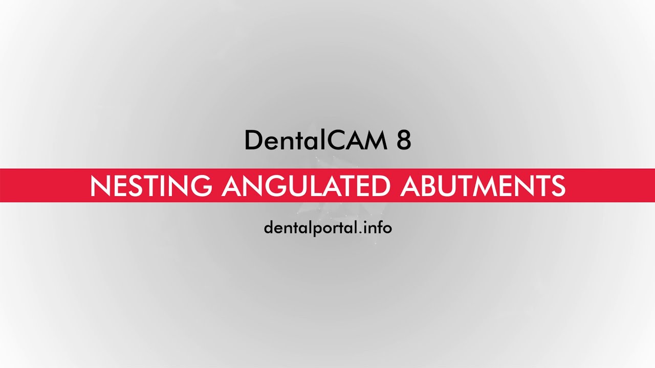 DentalCAM 8 –  Nesting angulated abutments