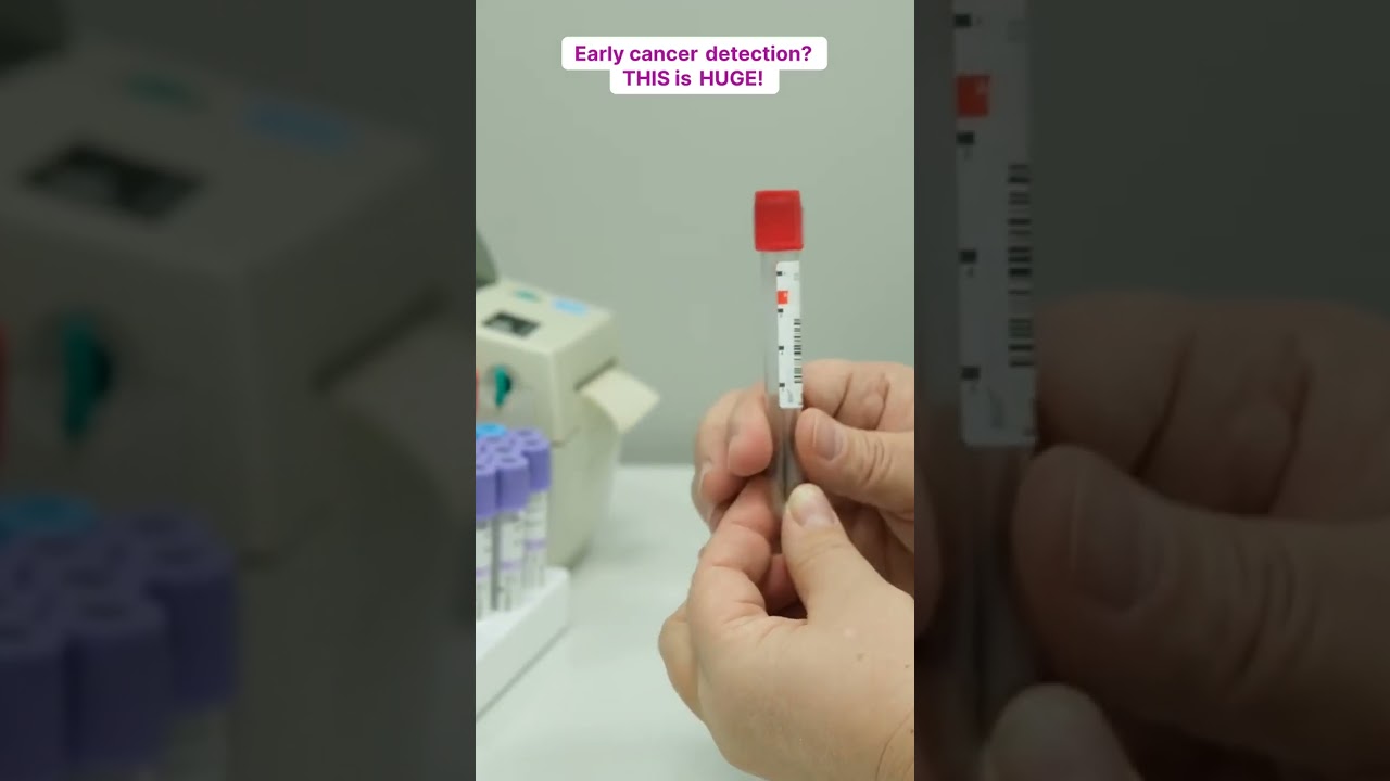 Revolutionary Blood Tests Could Transform Cancer Detection