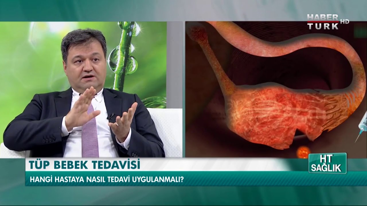 Doç. Dr. Ruşen Atmaca Tüp Bebekle İlgili Merak Edilenleri Anlatıyor