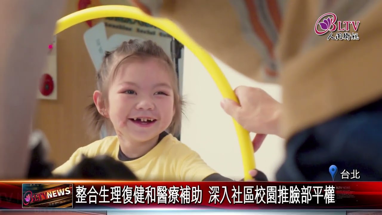 20260115全聯和陽光基金會合作零錢捐 呼籲支持燒傷顏損兒｜@FGSBLTV